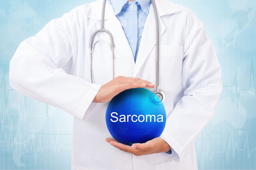 A Guide on Common Types of Sarcoma