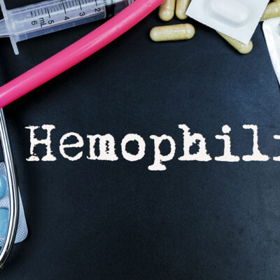 Everyday Tips for Hemophilia Management
